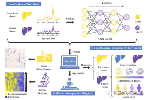 文献分享：基于拉曼光谱和深度学习的癌症快速无标签组织病理学诊断