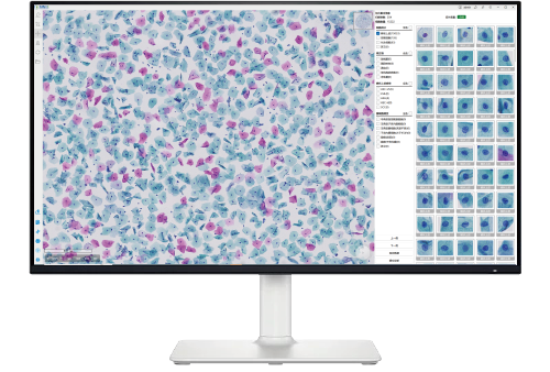 细胞学AI辅助诊断系统